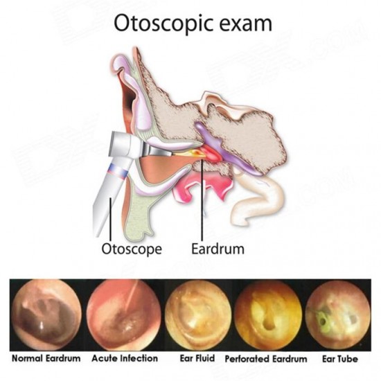 Pen Style Professional Ear Care Otoscope Auriscope Diagnostic Set